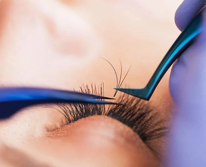 Eyelash Transplant
